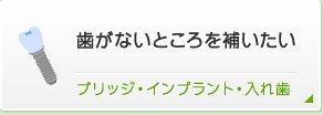 歯がないところを補いたいブリッジ・インプラント・入れ歯